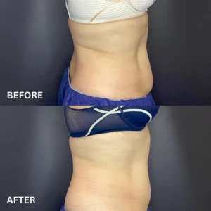 Belly Fat Reduction Effect